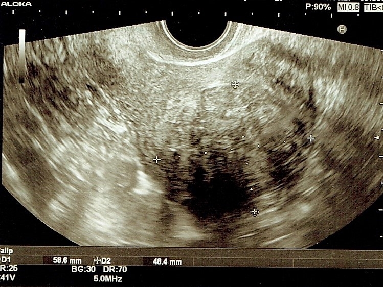 スキャン_20170815 (3)